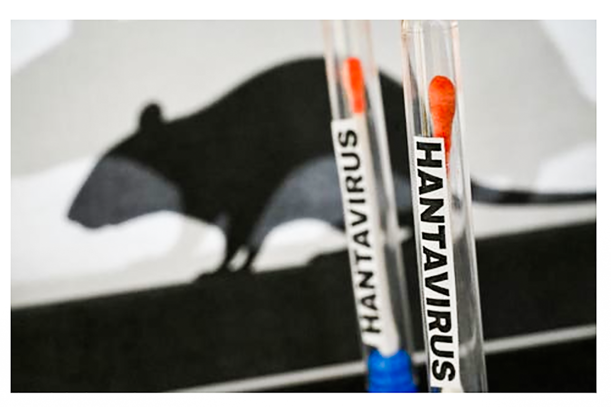 Andes hantavirus